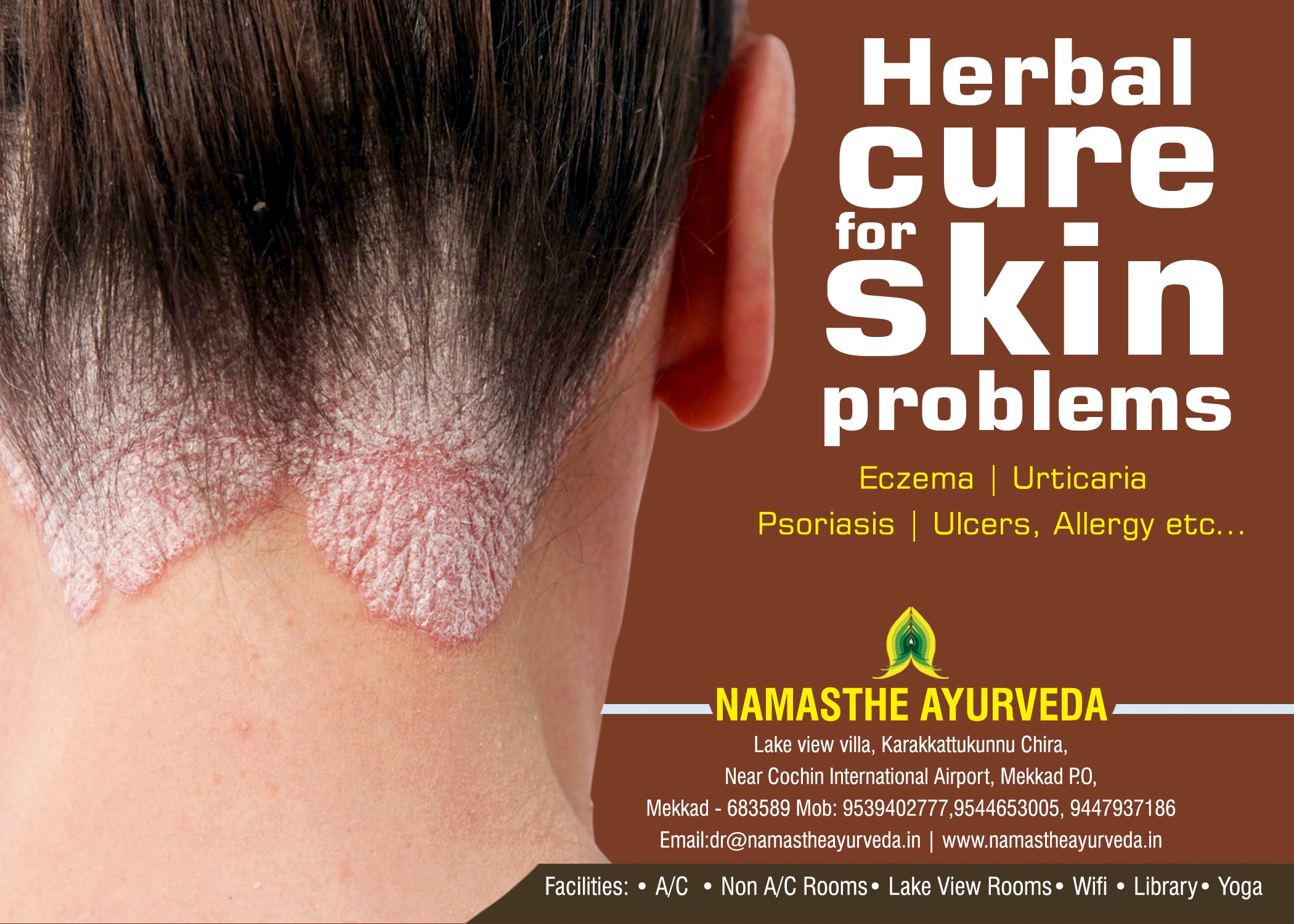 Namasthe Skin Diseases